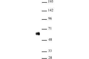 IRF-5 antibody (pAb) tested by Western blot Nuclear extract of THP-1 cells (20 µg) probed with IRF-5 antibody (1:500). (IRF5 antibody  (N-Term))