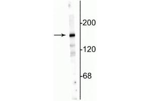 Western blot of 10 µg of rat hippocampal lysate showing specific immunolabeling of the ~180 kDa NR2A subunit. (NMDAR2A antibody  (N-Term))