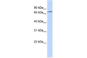 WB Suggested Anti-ZNF768 Antibody Titration: 0. (ZNF768 antibody  (N-Term))