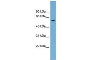 Image no. 1 for anti-Interferon-Induced Protein 44 (IFI44) (AA 359-408) antibody (ABIN6743412) (IFI44 antibody  (AA 359-408))