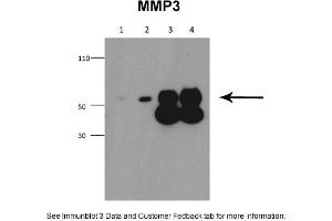Sample Type: 1. (MMP3 antibody  (Middle Region))