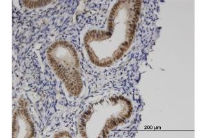 Immunoperoxidase of monoclonal antibody to ZMYND8 on formalin-fixed paraffin-embedded human endometrium.