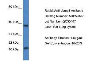 Western Blotting (WB) image for anti-Vesicle-Associated Membrane Protein 1 (Synaptobrevin 1) (VAMP1) (Middle Region) antibody (ABIN786034) (VAMP1 antibody  (Middle Region))