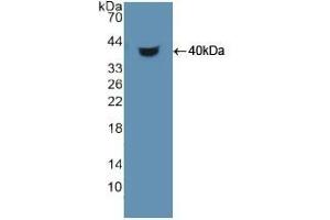 Detection of Recombinant HDGF, Human using Polyclonal Antibody to Hepatoma Derived Growth Factor (HDGF) (HDGF antibody  (AA 10-240))