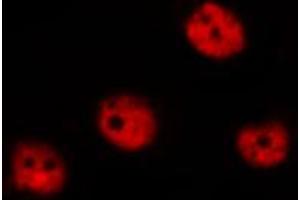 ABIN6267315 staining MOLT by IF/ICC. (Retinoblastoma 1 antibody  (pSer780))