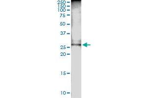 Immunoprecipitation of DCUN1D1 transfected lysate using anti-DCUN1D1 MaxPab rabbit polyclonal antibody and Protein A Magnetic Bead , and immunoblotted with DCUN1D1 MaxPab mouse polyclonal antibody (B01) . (DCUN1D1 antibody  (AA 1-259))