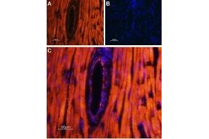 Expression of TRPML2 in rat heart - Immunohistochemical staining of rat heart paraffin-embedded sections using Anti-TRPML2 (Mucolipin-2) Antibody (ABIN7043337, ABIN7044041 and ABIN7044042), followed by AlexaFluor-555 secondary antibody. (Mucolipin 2 (MCOLN2) (AA 212-228), (Intracellular), (N-Term) antibody)