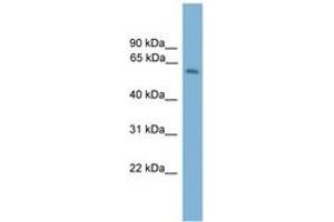 Image no. 1 for anti-Myosin Binding Protein H (MYBPH) (AA 171-220) antibody (ABIN6745565) (MYBPH antibody  (AA 171-220))