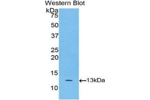 Western Blotting (WB) image for anti-Tumor Necrosis Factor Receptor Superfamily, Member 13C (TNFRSF13C) (AA 96-184) antibody (ABIN3208908) (TNFRSF13C antibody  (AA 96-184))