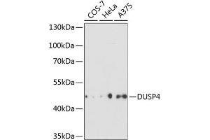 Western blot analysis of extracts of various cell lines, using DUSP4 antibody (ABIN3016539, ABIN3016540, ABIN3016541 and ABIN6219776) at 1:3000 dilution. (DUSP4 antibody  (AA 1-168))