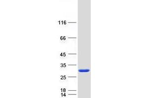 Validation with Western Blot