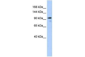 Human 293T; WB Suggested Anti-AMOTL1 Antibody Titration: 0. (AMOTL1 antibody  (N-Term))