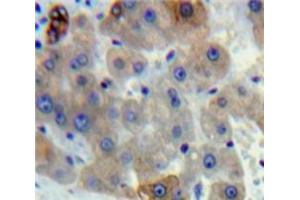 Used in DAB staining on fromalin fixed paraffin-embedded Liver tissue (gamma Lipotropin (AA 179-234) antibody)