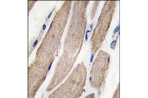 Image no. 1 for anti-Mitogen-Activated Protein Kinase Kinase 5 (MAP2K5) (Ser149) antibody (ABIN360284) (MAP2K5 antibody  (Ser149))