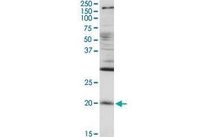 RGS5 MaxPab rabbit polyclonal antibody. (RGS5 antibody  (AA 1-181))