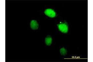 Immunofluorescence of purified MaxPab antibody to LHX4 on HeLa cell. (LHX4 antibody  (AA 1-390))