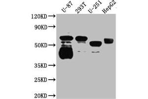Western Blot Positive WB detected in: U-87 whole cell lysate, 293T whole cell lysate, U-251 whole cell lysate, HepG2 whole cell lysate All lanes: Serotonin transporter antibody at 1:1000 Secondary Goat polyclonal to rabbit IgG at 1/50000 dilution Predicted band size: 71, 75 kDa Observed band size: 55 kDa (Recombinant SLC6A4 antibody)