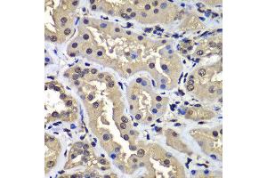 Immunohistochemistry of paraffin-embedded human kidney using CCAR2 antibody at dilution of 1:100 (x400 lens). (CCAR2 antibody)