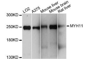 Western blot analysis of extracts of various cell lines, using MYH11 antibody. (MYH11 antibody  (AA 1680-1979))