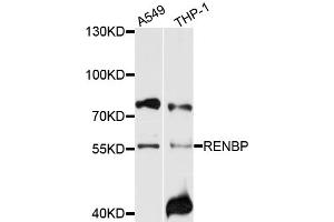 Western blot analysis of extracts of various cell lines, using RENBP antibody (ABIN6003719) at 1/1000 dilution. (RENBP antibody)