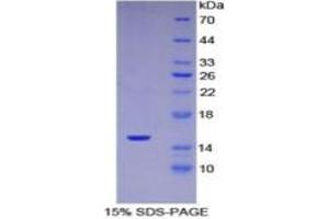 SDS-PAGE of Protein Standard from the Kit  (Highly purified E. (SERPING1 ELISA Kit)