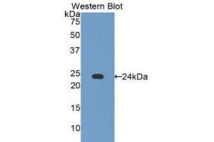 Western Blotting (WB) image for anti-Caspase 7, Apoptosis-Related Cysteine Peptidase (CASP7) (AA 24-198) antibody (ABIN1858252)