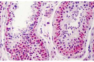 Human Testis: Formalin-Fixed, Paraffin-Embedded (FFPE) (NEK2 antibody  (AA 287-299))