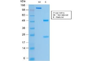 SDS-PAGE Analysis Purified CFTR Mouse Recombinant Monoclonal Antibody (rCFTR/1342). (Recombinant CFTR antibody)
