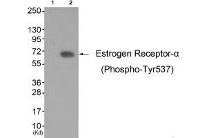 Western blot analysis of extracts from K562 cells (Lane 2), using Estrogen Receptor-α (Phospho-Tyr537) Antibody. (Estrogen Receptor alpha antibody  (pTyr537))