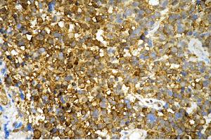 anti-Phosphoglycerate Kinase 1 (PGK1) antibody