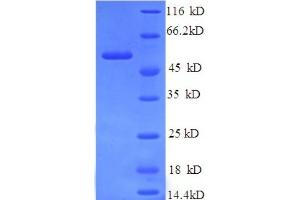 SDS-PAGE (SDS) image for Vinculin (VCL) (AA 2-235), (partial) protein (GST tag) (ABIN5712872)