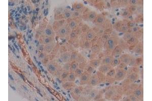 Detection of FGg in Human Liver Tissue using Polyclonal Antibody to Fibrinogen Gamma (FGg) (FGG antibody  (AA 166-416))