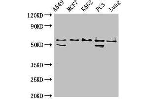 Western Blot Positive WB detected in: A549 whole cell lysate, MCF-7 whole cell lysate, K562 whole cell lysate, PC-3 whole cell lysate, Rat lung tissue All lanes: SERPING1 antibody at 2 μg/mL Secondary Goat polyclonal to rabbit IgG at 1/50000 dilution Predicted band size: 56, 50 kDa Observed band size: 56 kDa (SERPING1 antibody  (AA 23-300))