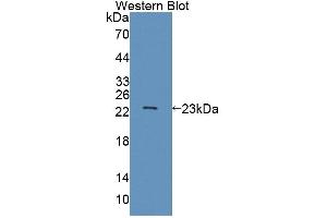 Western blot analysis of the recombinant protein. (ABCA9 antibody  (AA 1416-1583))