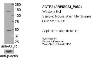 Western Blotting (WB) image for anti-Angiotensin II Receptor, Type 2 (AGTR2) (N-Term) antibody (ABIN2788290) (Angiotensin II Type 2 Receptor antibody  (N-Term))