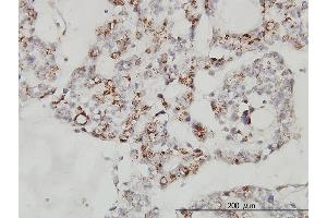 Immunostaining (ISt) image for anti-Multiple Coagulation Factor Deficiency 2 (MCFD2) (AA 1-146) antibody (ABIN566639)