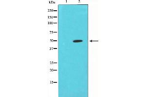 Western blot analysis of extracts from Jurkat cells, using CORO1A antibody.