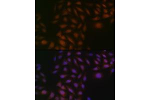 Immunofluorescence analysis of U-2 OS cells using Casein Kinase 2 beta (CSNK2B) (CSNK2B) Rabbit mAb (ABIN1680593, ABIN3019007, ABIN3019008 and ABIN7101698) at dilution of 1:100 (40x lens). (CSNK2B antibody)