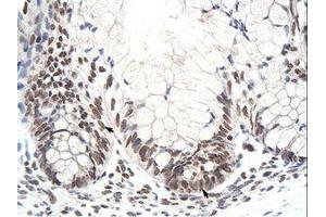 Image no. 1 for anti-Zinc Finger Protein 394 (ZNF394) (N-Term) antibody (ABIN6736210) (ZNF394 antibody  (N-Term))