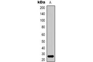 Western blot analysis of HMGB1 expression in HepG2 UV-treated (A) whole cell lysates. (HMGB1 antibody  (N-Term))