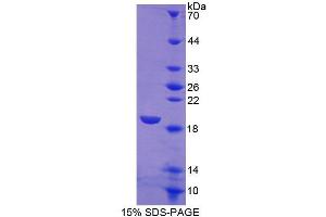 SDS-PAGE analysis of Human SIGLEC7 Protein.