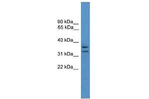 WB Suggested Anti-SCAMP3 Antibody Titration: 0. (SCAMP3 antibody  (N-Term))