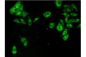 Figure:FITC staining on IHC-P Simple: Hela cells (TACR2 antibody  (AA 92-290))