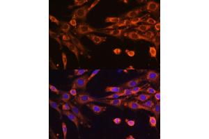 Immunofluorescence analysis of NIH-3T3 cells using SUPV3L1 Polyclonal Antibody (ABIN6132844, ABIN6148741, ABIN6148742 and ABIN6225286) at dilution of 1:100 (40x lens). (SUPV3L1 antibody  (AA 577-786))