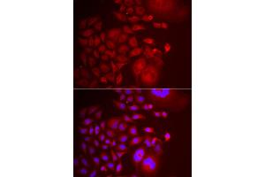 Immunofluorescence analysis of U2OS cells using TRAPPC10 antibody (ABIN5974105). (TRAPPC10 antibody)