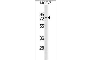 GNL1 Antibody (Center) (ABIN1538160 and ABIN2849092) western blot analysis in MCF-7 cell line lysates (35 μg/lane).