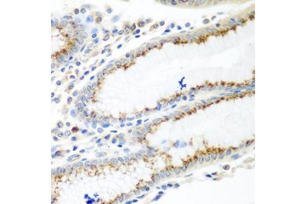 UBIAD1 antibody  (AA 1-100)