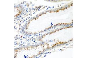 Immunohistochemistry of paraffin-embedded human stomach using UBI antibody (ABIN6134946, ABIN6149845, ABIN6149848 and ABIN6223555) at dilution of 1:100 (40x lens). (UBIAD1 antibody  (AA 1-100))