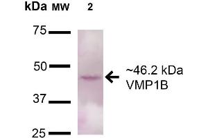 Western blot analysis of Rat Pancreas cell lysates showing detection of 46. (VMP1 antibody  (AA 391-402) (Atto 390))