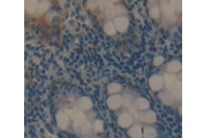 Used in DAB staining on fromalin fixed paraffin- embedded rectum tissue (PA2G4 antibody  (AA 2-394))